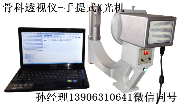 两种不同成像原理的便携式X光机